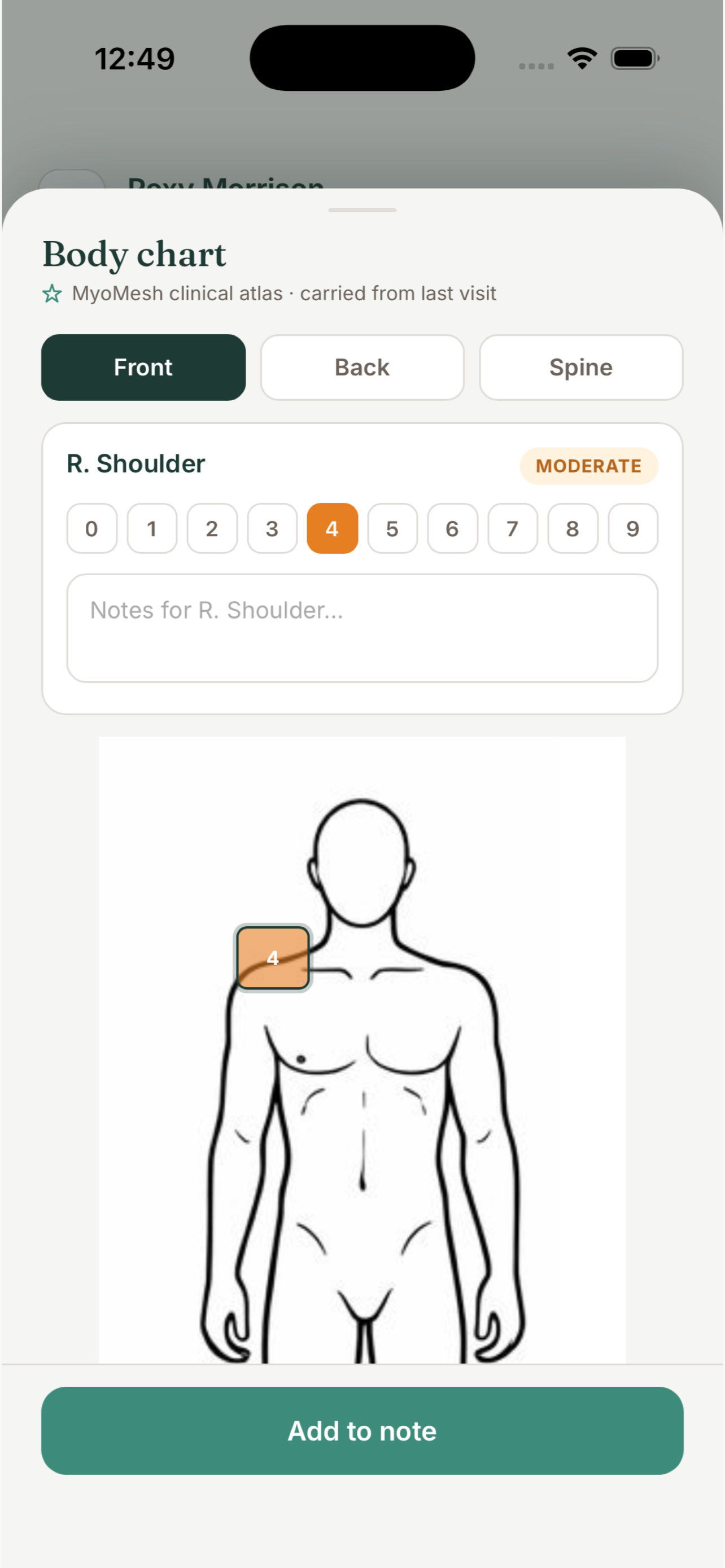 Clinical body chart with a shoulder finding