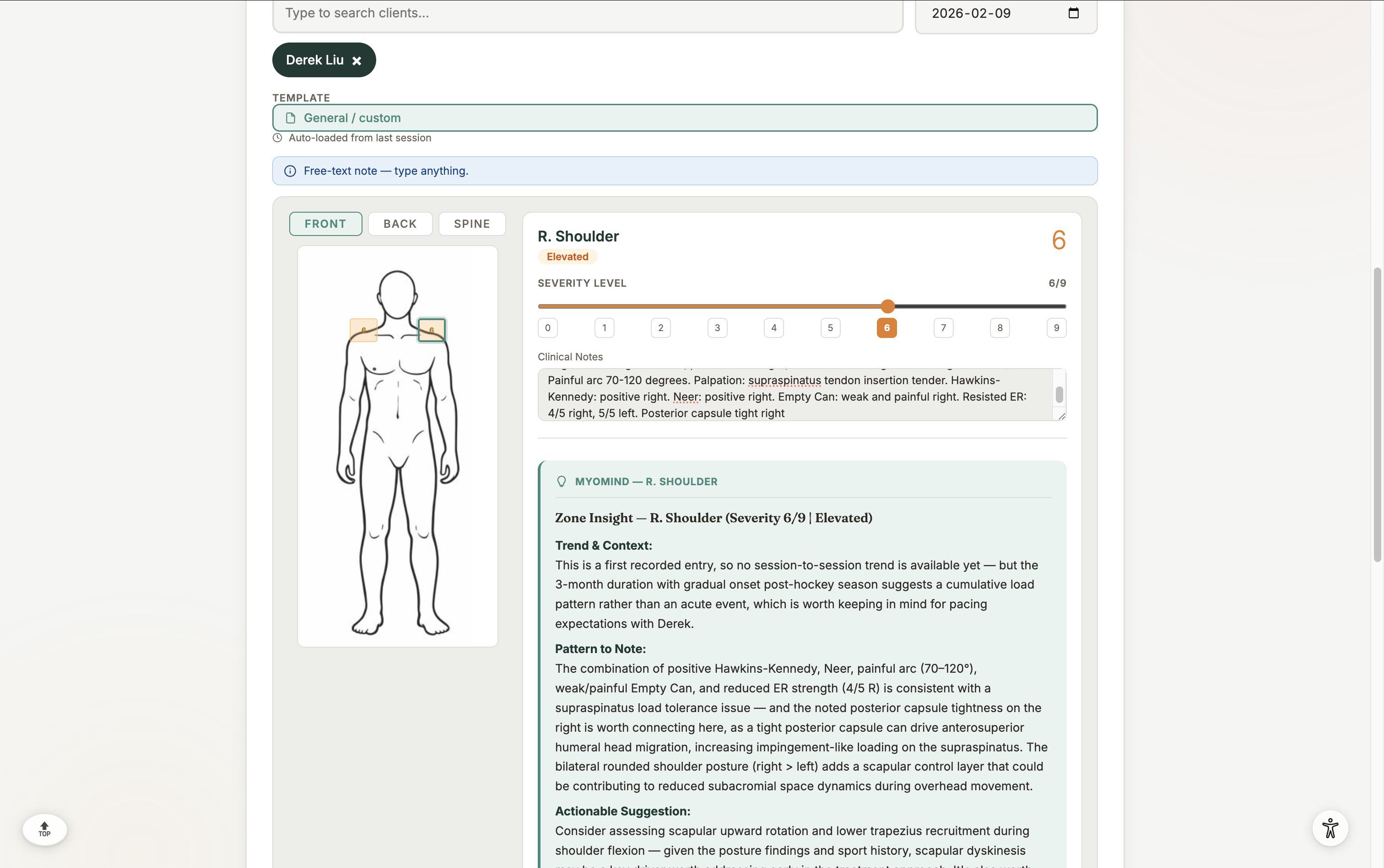 MyoMind AI clinical intelligence panel showing SOAP generation and pre-visit briefs